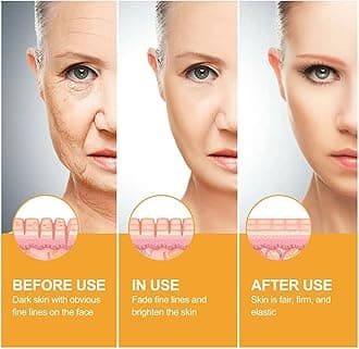 FirmTox Collagen Astaxanthin Lifting Ampoule,Astaxanthin Collagen Gel Ampoule,Anti Ageing & Anti Wrinkle Serum,Moisturizing Lifting Ampoules,Collagen Boosting Serum for All Skin Types (1 Pcs)