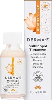 Sulfur Spot Treatment – Sulfur and Salicylic Acid Lotion for Breakout-Prone Skin – Soothing Spot Treatment for Face Tones, Balances and Reduces Irritation, 1 Fl Oz