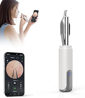 Blackhead Remover Tweezer with 1080P Camera, UV Light – USB Rechargeable Precision Tweezers for Ingrown Hair, Ear Hair, Eyebrows, Pore Extractor Tool for Men and Women (Pearl White)