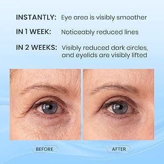 Dual Eye Cream - Advanced Retinol and Peptides Formula for Reducing Puffiness, Dark Circles, and Wrinkles, Fragrance-Free, 0.68 oz